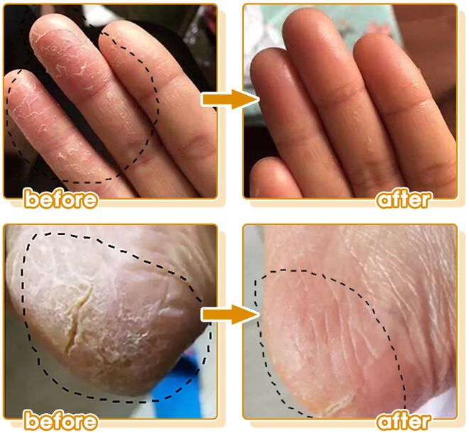 士研发的身体乳“学霸”成分抹了！开元棋牌网站干到发痒？一群清华博(图12)